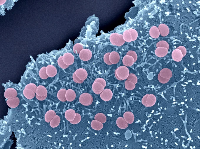 Bactéries Neisseria meningitidis adhérant à la surface de cellules épithéliales. Les diplocoques sont enchevêtrés dans des microvillosités d'origine cellulaires. Les bactéries Neisseria meningitidis constituent l'une des causes majeures de méningites aiguës.
Crédit © Institut Pasteur/Perrine Bomme, Plate-Forme Microscopie Ultrastructurale, Guillaume Duménil, INSERM U970, Paris Centre de Recherche Cardiovasculaire, HEGP - Colorisation Jean-Marc Panaud.