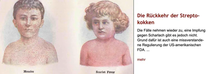 Zeichnung von Kopf und oberem Rumpfs eines Jungen und eines Mädchens. Der Junge ist von Masern-Ausschlag übersät, das Mädchen mit Scharlach-Flecken. Rechts daneben Überschrift "Die Rückkehr der Streptokokken" des im Post verlinkten Artikels, gefolgt von dessen Vorspann.