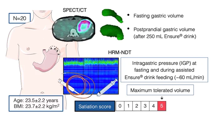 Single-photon emission computed tomography/computed tomography (SPECT/CT) and combined high-resolution manometry with nutrient drink test (HRM-NDT) are proposed as physiological, quantitative, and minimally invasive techniques for measuring GA response.

While both procedures are feasible and well-tolerated, patient studies and future efforts to optimize and standardize GA study protocols are warranted.