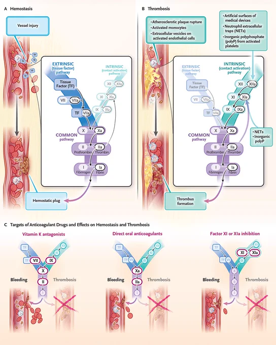An illustrated diagram of factor XI and uncoupling thrombosis and hemostasis. 