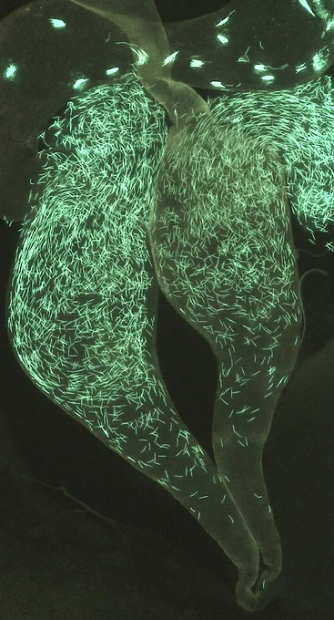 A photo of female Drosophila melanogaster seminal receptacle with GFP tagged sperm.