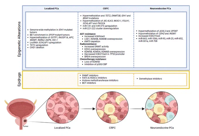 Evolution of prostate cancer (PCa) and associated epigenetic changes at different disease stages (localized PCa, castration-resistant PCa (CRPC), and neuroendocrine PCa), along with potential epidrug classes for administration in CRPC and neuroendocrine PCa stages. Abbreviations: BET - Bromodomain and extraterminal motif; CRPC – Castration-resistant Prostate Cancer; DNMT - DNA methyltransferases; Epidrug – Epigenetic drug; HAT - Histone acetyltransferases; HDAC - histone deacetylases; LncRNA – long non-coding RNA; miRNA- microRNA; PCa – Prostate Cancer.