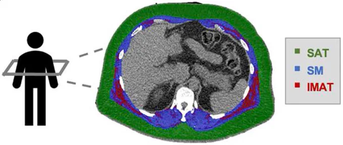 Researchers used CT scans to analyse patient body composition in a section of their torso.