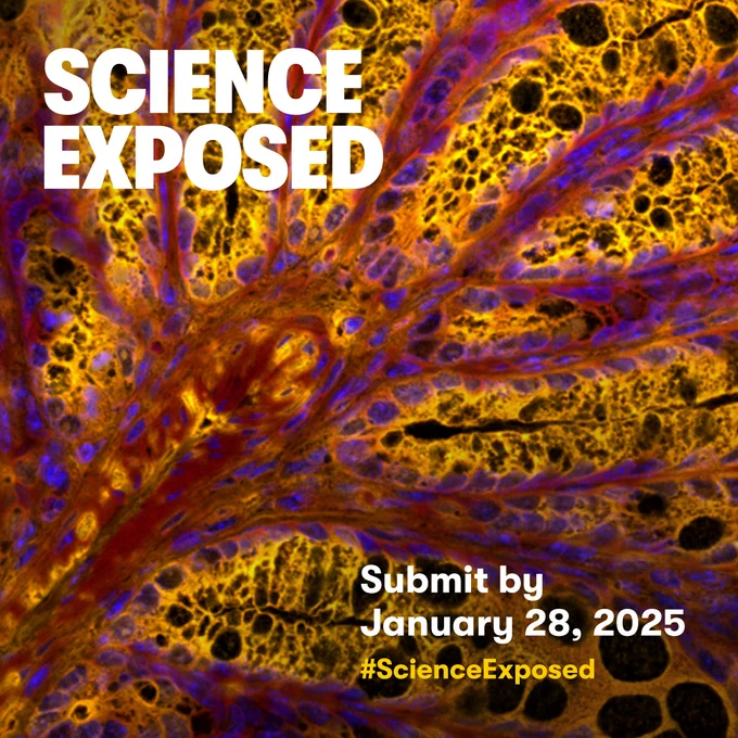 In the background, we see one of the winning images of Science Exposed 2024, showing a mouse colon stained with an oxidation-sensitive dye that allows us to visualize oxidative stress. On top of the image we see, in white, the title of the context and “Submit by January 28, 2025” as well as the hashtag #Science Exposed in yellow. Background image by James Sousa from University of Calgary.