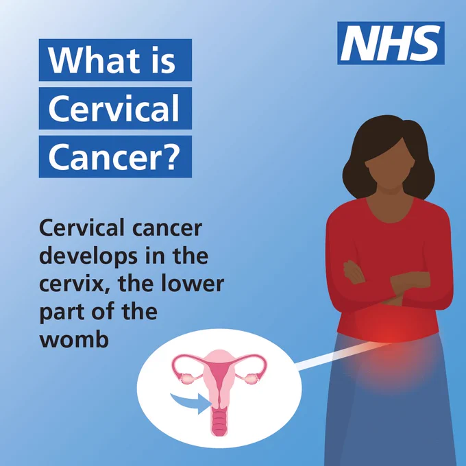 An illustration of a woman, with a small graphic illustrating a cervix. Text reads 'What is cervical cancer? Cervical cancer develops in the cervix, the lower part of the womb'