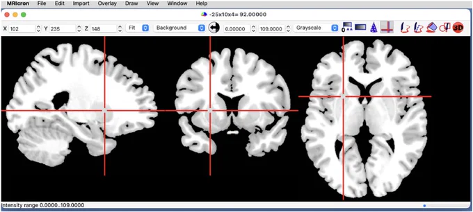 Screenshot of the MRIcron user interface on macOS. The main menu provides access to core functions. Users can change the crosshair position by clicking on the image or setting the coordinates in the top toolbar, allowing users to specify the crosshair coordinates (with X, Y, Z referring to the column, row and slice of the image). The title bar reports the crosshair location in world space as well as the voxel intensity. Likewise, users can set contrast and brightness by dragging over the image or using the minimum and maximum thresholds in the titlebar. A pull-down menu allows the user to select the color scheme (here Grayscale). Buttons in the toolbar allow the user to display a gradient colorbar and draw lesions. The bottom status bar reports recent changes (here the new contrast values).