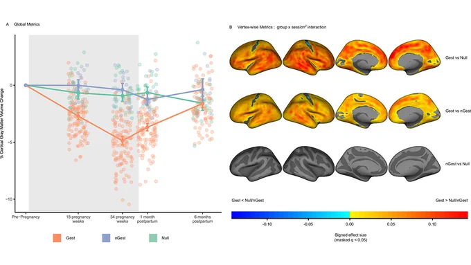 This is figure 1, which shows longitudinal cortical gray matter volume trajectory across pregnancy and postpartum (N = 179). 