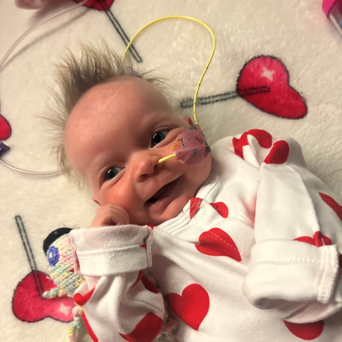 Dolcie-Mae wearing a white onesie with red hearts, adorned with a headband and a medical nasal tube, smiling and lying on a blanket with heart designs.