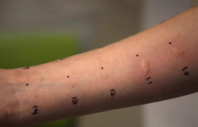 Arm with numbers written on it