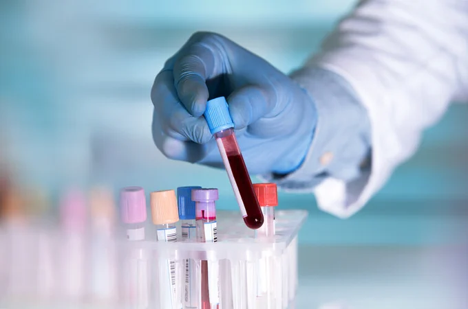 Image of scientist's gloved hand next to a set of test tubes in a laboratory. The test tube he is holding contains a red liquid.