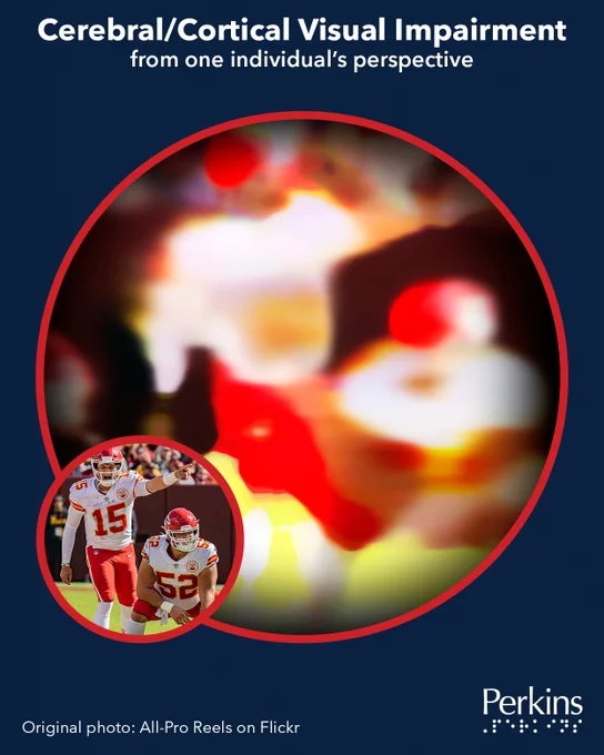 A blurry, distorted scene containing red, yellow, and white splotches surrounded by dark, cloudy edges next to a small circle containing a scene of two football players in red and white jerseys. Text: Cerebral/Cortical Visual Impairment from one individual’s perspective