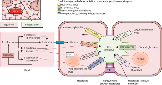 Figure showing hepatobiliary transporter proteins involved in biliary excretion. Copyright: 2024 Published by Elsevier Ltd.