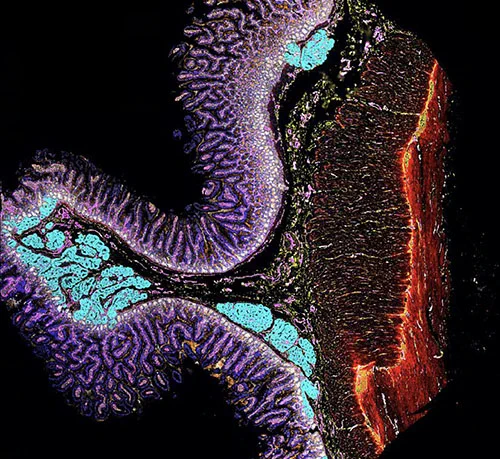 CODEX Image of the Duodenum Region of the Intestines

Blue – nuclei, Green - IgM plasma cells, Orange - goblet cells, Cyan- epithelial cells, White - epithelial stem cells, Pink - Endothelial cells, Red - extra cellular matrix, Yellow - stromal cells