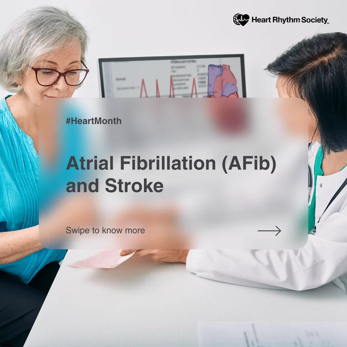 Atrial Fibrillation (Afib) and Stroke