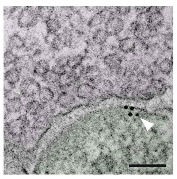 Immunogold-labeled GABA receptor in post-synaptic patient-derived DIPG cell (green). Presynaptic neuron shown in lavender. 