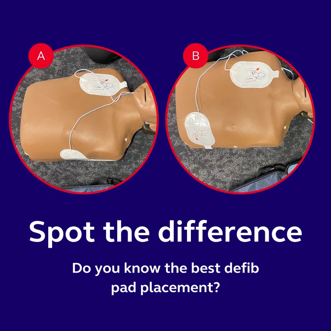 The image shows a side-by-side comparison of two defibrillator pad placements on a CPR training mannequin, labeled "A" and "B." The background is dark blue, and the text reads:
"Spot the difference. Do you know the best defib pad placement?"
In image A, one pad is placed on the mannequin's upper right chest, while the other is positioned on left hand side of the rib cage, close to the armpit.
In image B, one pad is also placed on the upper right chest, but the other one is placed on the left hand side, further away from the armpit and almost on top of the ribcage.