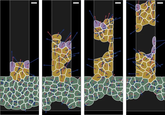 A schematic showing the evolution of rupture for a simulation of cancer cells in a microchannel 50 micrometers wide. Side-by-side, vertical images show the microchannel at four times. Below the channel in each image is a pool of “follower” cells — green polygons with red and blue arrows pointing in different directions. Directly above the green polygons, at the bottom of the channel, are “guided” cells — yellow polygons that contain longer red and blue arrows. Sparse purple polygons, or “leader” cells, are located at the top of the guided cells. From left to right, follower cells decrease while guided cells increase, move up the channel, and break apart. The rightmost image, at the last timestamp, shows the guided cells broken up into two clumps, with leader cells at the top of both clumps.