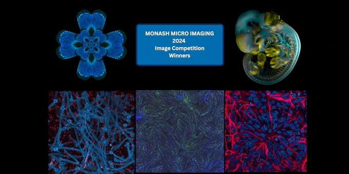 Top Right: 1st  Place Winner: Jan Manent "Of nerves and Bones" (ARMI)

Bottom Left: 2nd Place Winner: Francois Olivier " A Spaghetti World" (Biochemistry, BDI)

Bottom Middle: 3rd Place Winner: Esther Garcia-Dominguez "A Starry Fibre Night: A Van Gough Reverie" (ARMI)

Bottom Right: 3rd Equal Place Winner: Ana Antonic-Baker "Neurites are red, nuclei are blue" (Neuroscience, ARA )

Top Left: Sci-Art Category Winner: Crystal Li "Purkinje Petals" (Neuroscience, ARA )