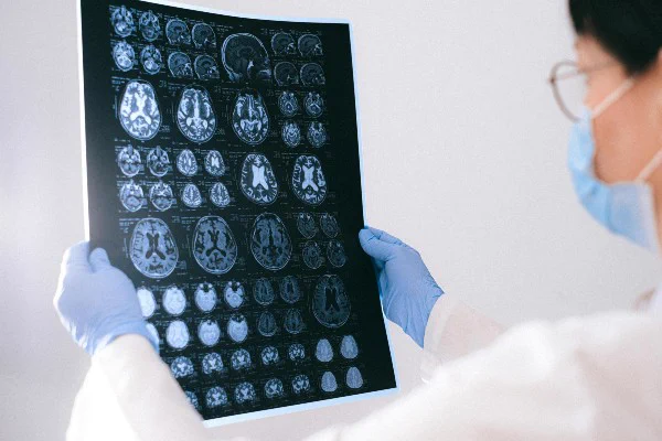 Clinician looking at brain scans