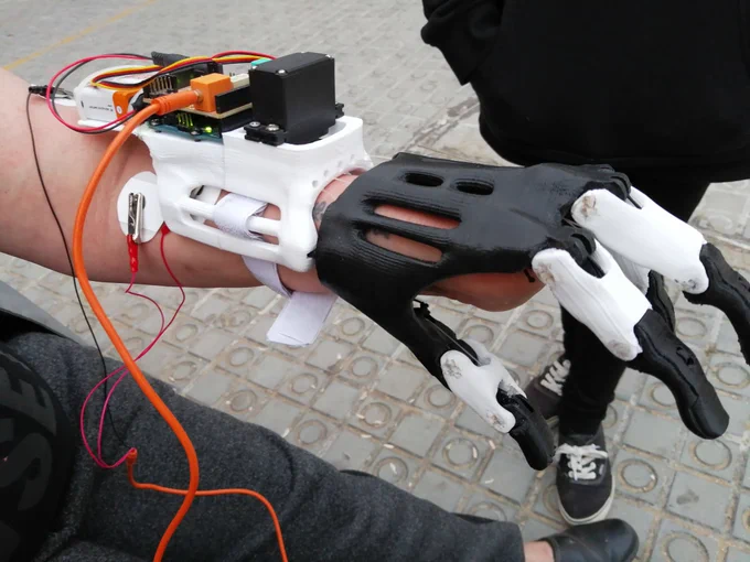 A custom-built robotic prosthetic hand made by Jorge Iglesias Costas, using an EMG sensor from Backyard Brains. The hand is black and white, made of plastic, and is being used by a person born without left-hand fingers.