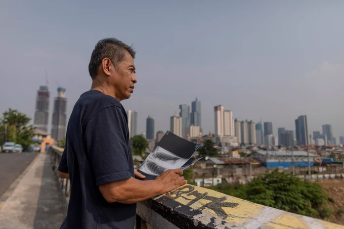 Istu Prayogi (58) watches skyscrapers with x-rays of his health condition in his hand. Every morning he coughs and spits out ripples of thick blood, affected by the air pollution. Jakarta, Indonesia.

Credit: Aji Styawan / Climate Visuals
