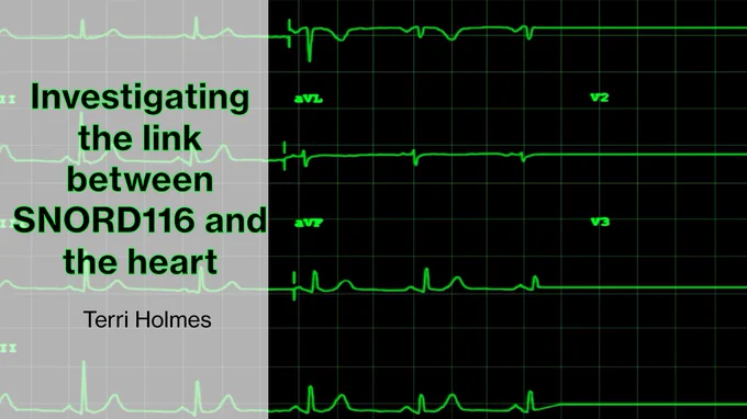 A presentation slide with a dark background features an electrocardiogram (ECG) graph with green waveform lines on a black grid. On the left side, a semi-transparent gray rectangle overlays part of the ECG graph, containing text in bold green font that reads: 'Investigating the link between SNORD116 and the heart.' Below this, in smaller black font, is the presenter's name, 'Terri Holmes.'