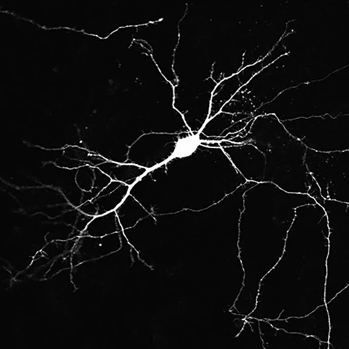 White neuron on black background with a bright cell body and branching extensions.