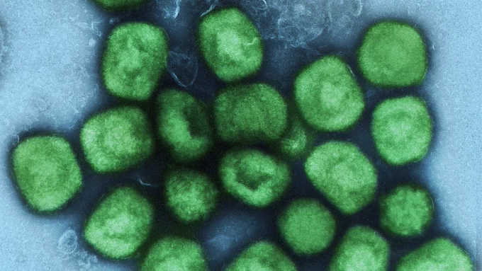 Mpox-Viruspartikel (eingefärbte elektronenmikroskopische Aufnahme) © National Institute of Allergy and Infectious Diseases (NIAID)