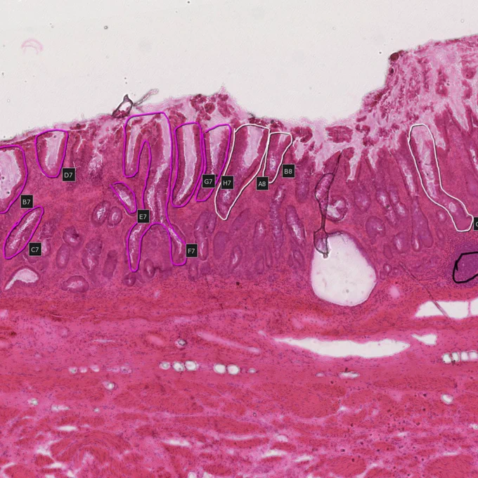 Histology images of stomach lining tissue samples, some of which have highlighted sections showing where cells were extracted to be sampled. Credit: Grace Collord