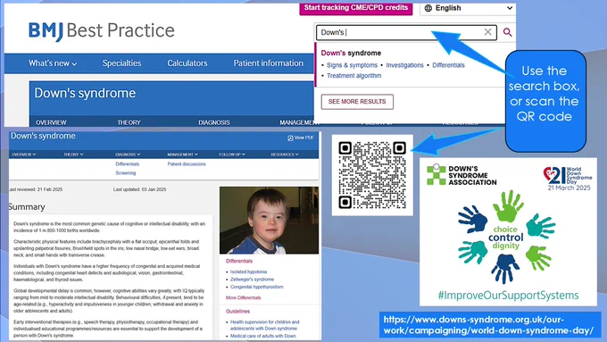 Screenshots of Down's Syndrome information from BMJ Best Practice and World Down's Syndrome Day Logo from Down's Syndrome Association website