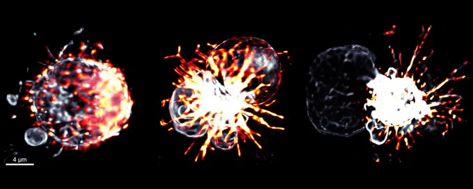 Lattice light-sheet microscopy revealed how different antibodies bound to CD20 (red-hot) expressed in microvilli of B cells, leading to their accumulation to one side of the cell. Actins are depicted in grey.

