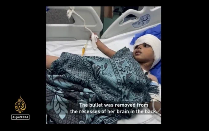 Screenshot from documentary showing Mira, now in a hospital bed, heavily bandaged over the head, with a green scarf laid over her like a blanket