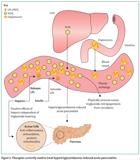 Intravenous insulin activates LPL, which increases the clearance of triglycerides from the circulation. Heparin binds to HSPG and releases LPL, leading to a reduction in plasma triglycerides. Heparin also reduces inflammation, oxidative stress, and protects mitochondria in acinar cells of the pancreas. These effects are independent of the triglyceride-lowering effect of heparin. Plasma exchange (plasmapheresis) removes triglycerides directly from circulation. HSPG=heparan sulphate proteoglycan. LPL=lipoprotein lipase.