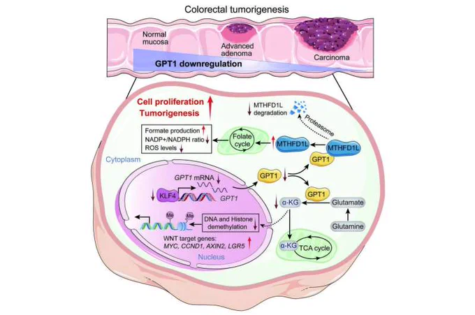 Schematic model illustrating the mechanisms of GPT1 in CRC tumorigenesis. Credit: Science Translational Medicine (2025). DOI: 10.1126/scitranslmed.adp9805