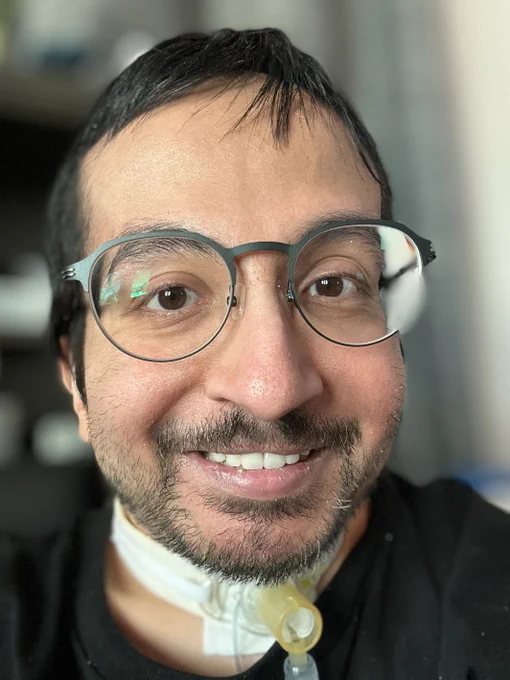 Smiling close-up selfie of a person wearing round, gray computer glasses with blue-tinted lenses, short dark hair, facial hair, and a tracheostomy tube.