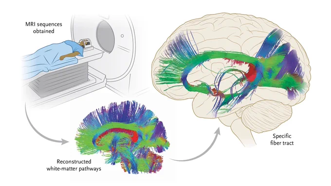 Visual representation of an anatomical connectivity map