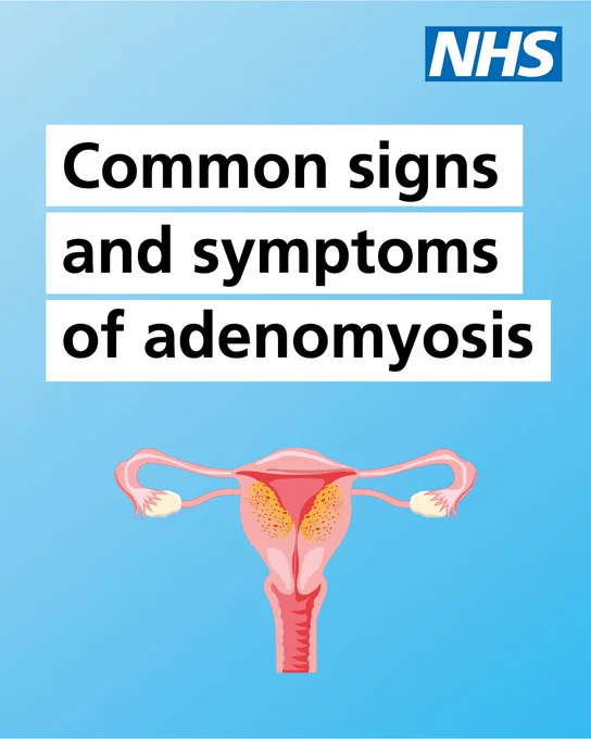 A blue NHS-branded graphic titled "Common signs and symptoms of adenomyosis." Below the text is a medical illustration of a uterus.