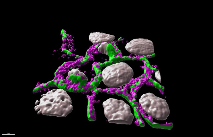 The phosphorylated form of α-catenin localizes to the apical portion of adherens junctions. The image shows 3D surface rendering using Imaris software of a confocal image of a dividing kidney epithelial cell line (Madin–Darby canine kidney or MDCK cells). Phosphorylated α-catenin is shown in magenta and adherens junctions are in green.
The phosphorylated form of α-catenin localizes to the apical portion of adherens junctions. The image shows 3D surface rendering using Imaris software of a confocal image of a dividing kidney epithelial cell line (Madin–Darby canine kidney or MDCK cells). Phosphorylated α-catenin is shown in magenta and adherens junctions are in green.