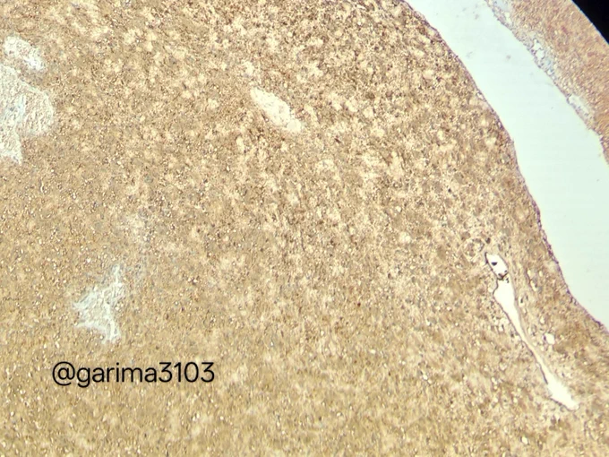IHC S100