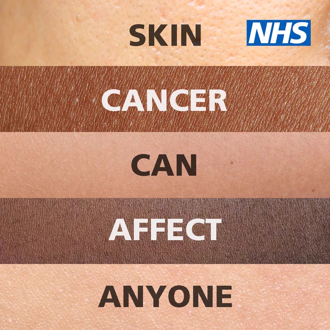 An image of 5 different skin tones, each skin tone features a word. The text reads 'Skin cancer can affect anyone'.