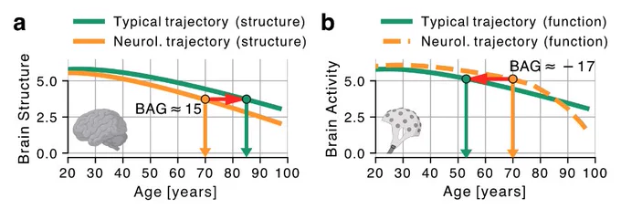 Figure 4 from our preprint, proposing a theoretical model for why EEG and other brain-activity measures might deliver inaccurate or surprising and pradoxical brain-age estimates.