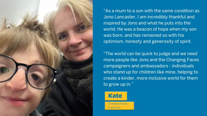 "As a mum to a son with the same condition as Jono, I am incredibly thankful and inspired by Jono and what he puts into the world. He was a beacon of hope when my son was born, and has remained so with his optimism, honesty and generosity of spirit.
"The world can be quick to judge and we need more people like Jono and the Changing Faces campaigners and ambassadors - individuals who stand up for children like mine, helping to create a kinder, more inclusive world for them to grow up in.”