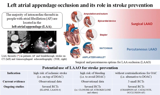 Graphic abstract in Seiffge et al.
