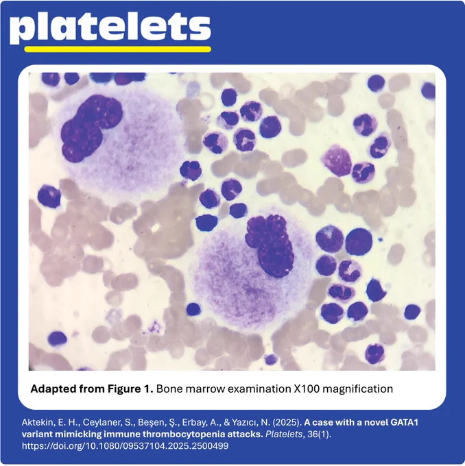 Adapted from Figure 1. Bone marrow examination X100 magnification, from Aktekin et al. (2025).
https://doi.org/10.1080/09537104.2025.2500499