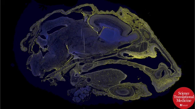 Microscopic cross-section of a mouse head stained with fluorescent markers, showing ASO 449323–Cy3, yellow, and nuclei stained blue in the brain; Science Translational Medicine logo in the corner.
