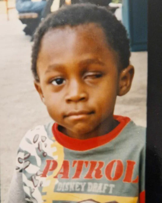 An old photo of Michael, a young black boy whose left-eye has been removed.