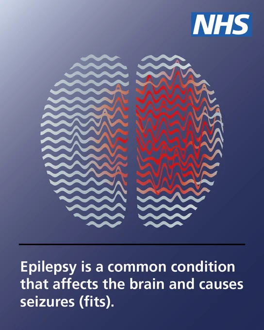 An illustration of a brain. The right side of the brain is showing increased brain activity. Text reads 'Epilepsy is a common condition which affects the brain and cause seizures (fits.)'