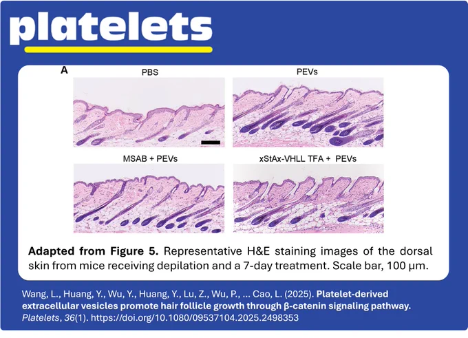Adapted from Figure 5. Representative H&E staining images of the dorsal skin from mice receiving depilation and a 7-day treatment. Scale bar, 100 μm. From Wang, et al. (2015).

https://doi.org/10.1080/09537104.2025.2498353