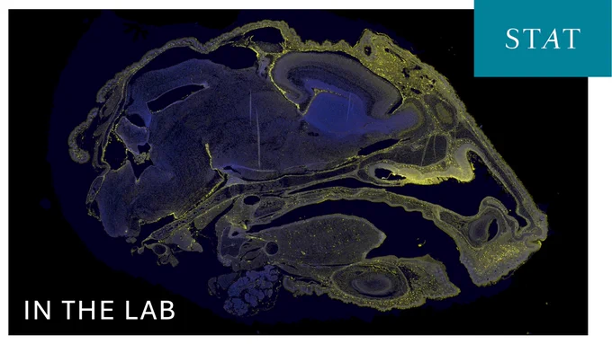 Microscopic cross-section of a mouse head stained with fluorescent markers, showing ASO 449323–Cy3, yellow, and nuclei stained blue in the brain; STAT news logo in corner and "In The Lab" in lower left