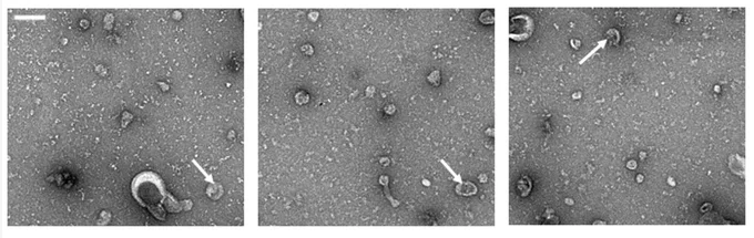 The Chung Lab’s extracellular vesicles (EVs) — naturally derived particles released from cells that have been genetically engineered to enhance their therapeutic benefits.  